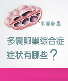 贵港红房子妇产医院_多囊卵巢综合症的表现症状有哪些？